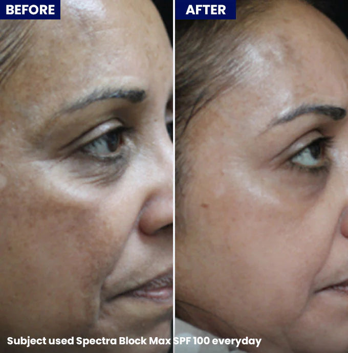 Spectra Block Max SPF 100 PA+++