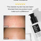 BHA Blackhead Power Liquid 100ml